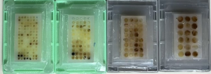 Compact TMA recipient blocks containing tissue cores.
