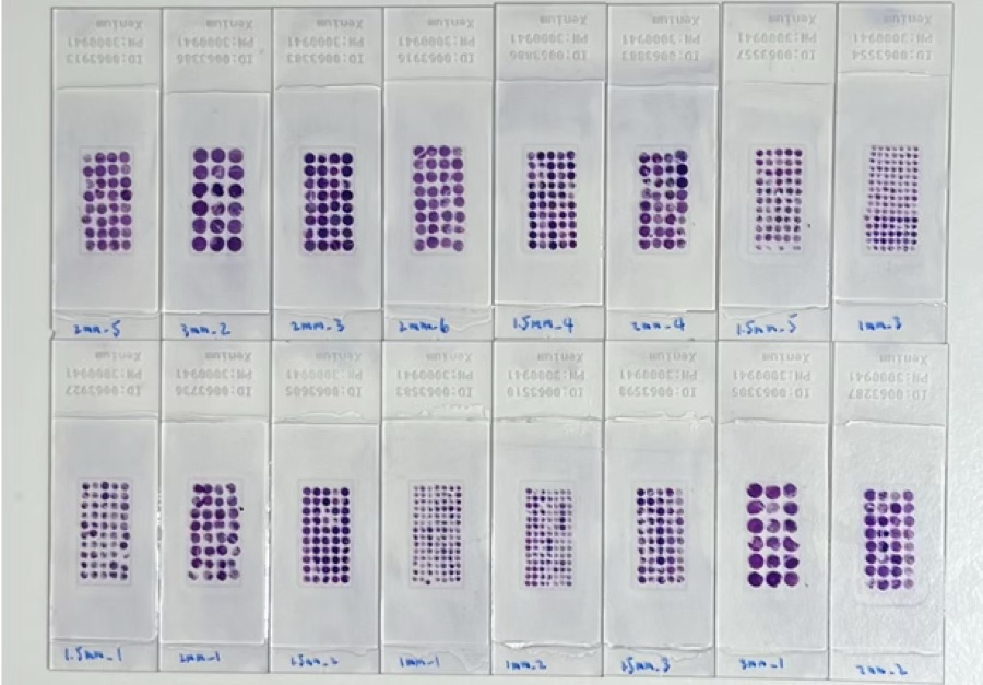 Sixteen tissue microarray sections mounted on Xenium slides.